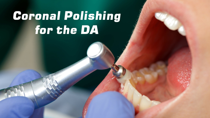 Coronal Polishing for the Dental Assistant