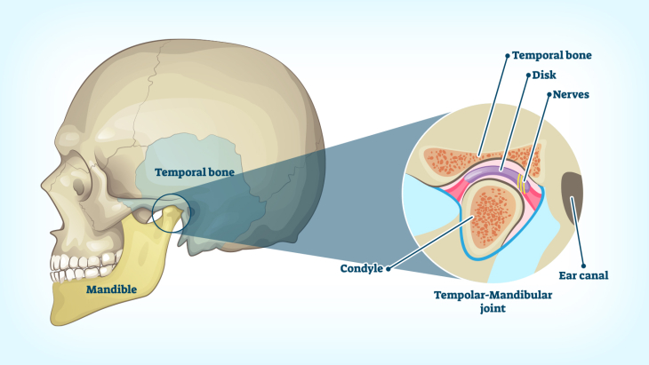 Temporomandibular Joint Dysfunction: Evaluation and Treatment