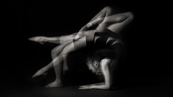 Ehlers-Danlos Syndrome (EDS) and Hypermobility Spectrum Disorder (HSD) -- An Overview for Rehab Professionals